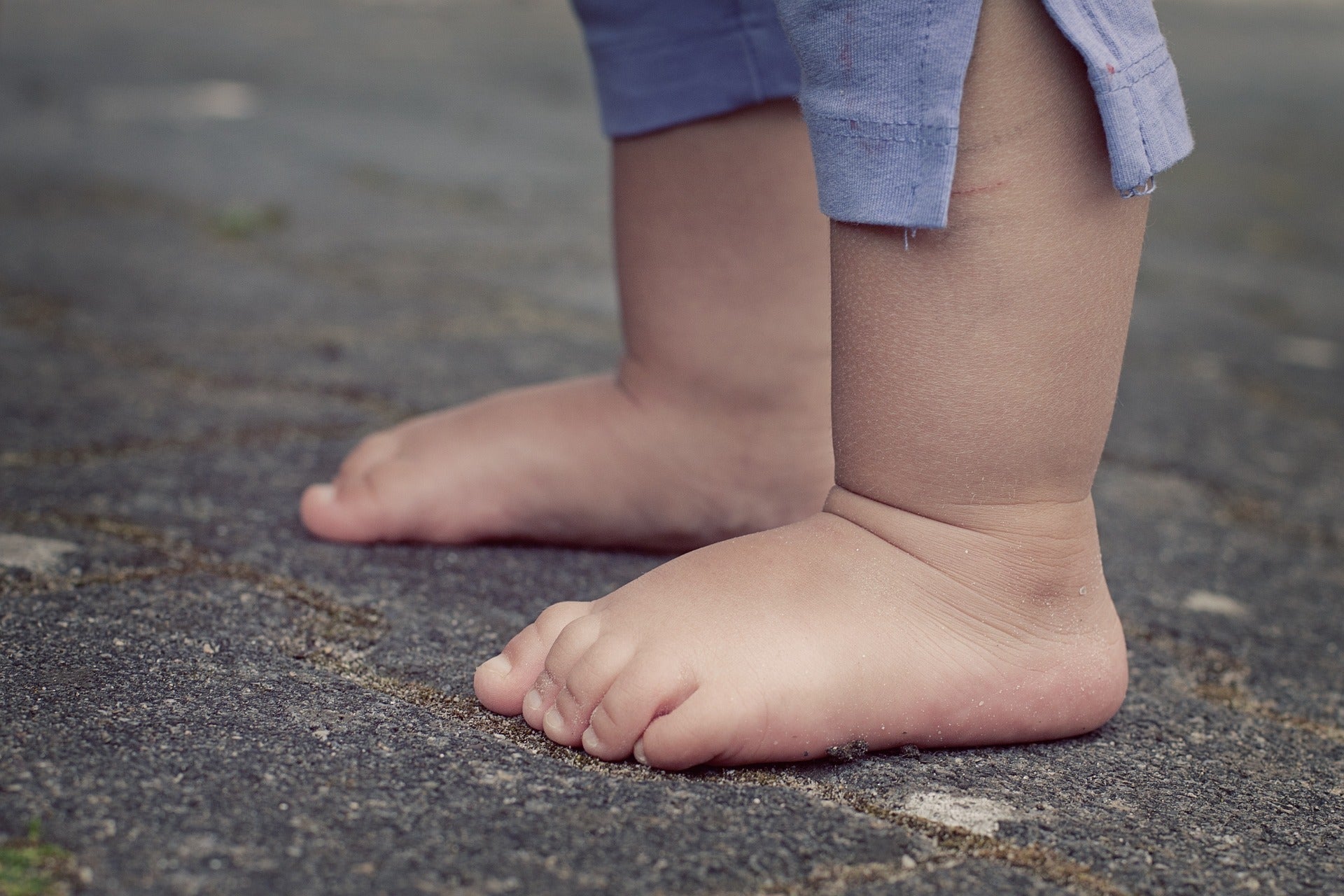 Rétention d’eau dans les jambes